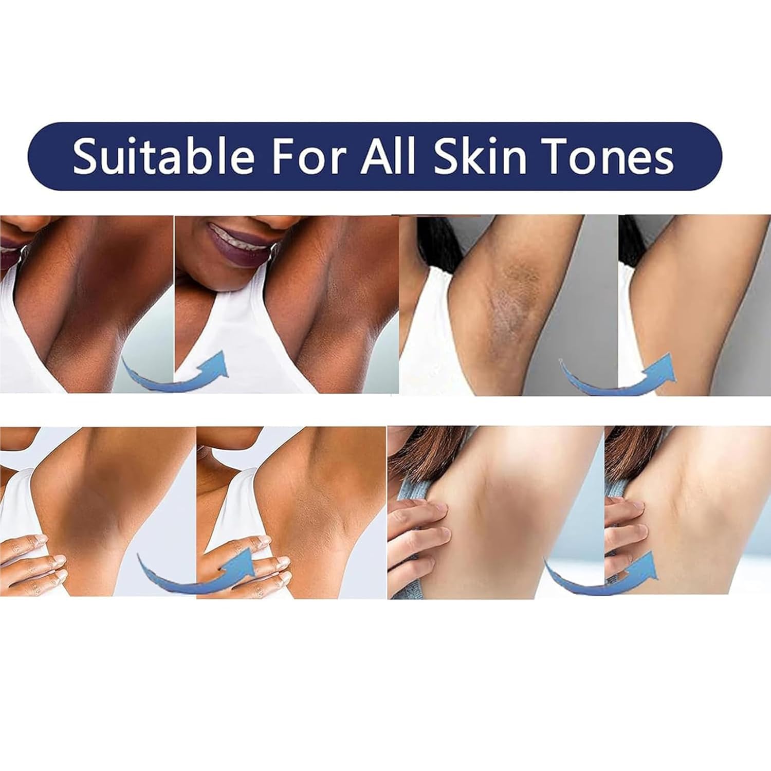 Skin Bleaching Cream Skin Lightening for Body Intimate Areas, Private Parts, Underarm, Knees, Elbows, Inner Thigh, Bikini Area, Whitening Cream Dark Spot Remover For Intimate Areas (1FL OZ)