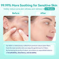 Face Towels, 10"ÌÑ12" Disposable Face Towel, Face Towelettes XL, Ultra Soft